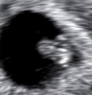 Heartbeat at 6 weeks 1 day