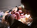 Baby in a warming tray cared for by her father after childbirth.]]