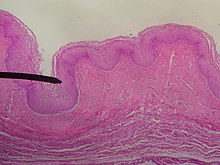 Mikroskopischer Schnitt durch die Vaginalwand der Frau