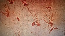 Causative agent: Salmonella enterica serological variant Typhi (shown under a microscope with flagellar stain)