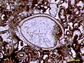 Image 20Articulated ostracod valves in cross-section from the Permian of central Texas; typical thin section view of an ostracod fossil (from Ostracod)