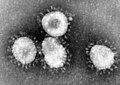 Vier Viren in der elektronenmikroskopischen Aufnahme (schwarz-weiß) mit den für Coronaviren typischen Fortsätzen, die an eine Sonnenkorona erinnern.