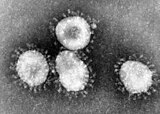 HCoV-229E virus