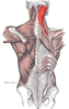 Splenius muscle