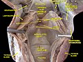 Deep dissection of human larynx, pharynx and tongue seen from behind