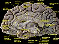 Medial surface of right cerebral hemisphere. Cuneus labeled at right.