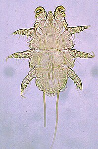 Myobia musculi rodent fur mite