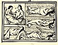 Image 12An illustration in Florentine Codex, compiled between 1540 and 1585, depicting the Nahua peoples suffering from smallpox during the conquest-era in central Mexico (from Indigenous peoples of the Americas)