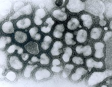 Transmission electron micrograph of influenza A viruses (light objects on a dark background).