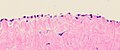 Histology of the peritoneal mesothelial lining, and underlying fibrous tissue. H&E stain.