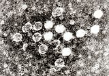 Electron micrograph of Parvovirus B19