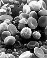 SEM image of normal circulating human blood. This is an older and noisy micrograph of a common subject for SEM micrographs: red blood cells.