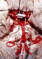 Human brainstem blood supply