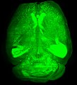 A mouse brain (Thy-1 GFP-M) cleared using 3DISCO method and imaged by light-sheet microscopy.
