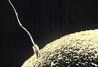 Micrograph of a sperm and egg.