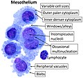 Cytology of the normal mesothelial cells that line the peritoneum, with typical features.[9] Wright's stain