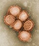 Koloriertes, elektronenmikroskopisches Bild einiger Influenza-A/H1N1-Viren