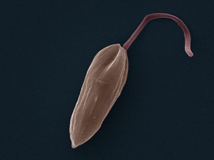 Promastigote: False colour SEM micrograph of promastigote form Leishmania mexicana. The cell body is shown in orange and the flagellum is in red. 119 pixels/μm.