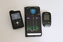 Insulinpumpe und Blutzuckermessgerät, die mit einer App auf dem Smartphone gekoppelt sind (2021)