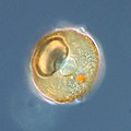 Arcella sp. test (Lobosa: Tubulinea)