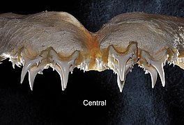 Central upper teeth