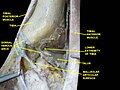 Dorsum of Foot. Ankle joint. Deep dissection.