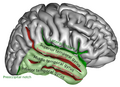 Right temporal lobe (shown in green). Superior temporal gyrus is visible at the top of the green area.