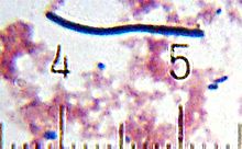 "Lactobacillus delbrueckii" subsp. "bulgaricus" from a sample of yogurt. Numbered ticks are 11 μm apart.