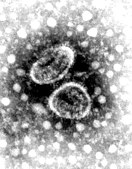 Torovirus in human faeces