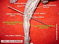 Gastrocnemius muscle (dissection)