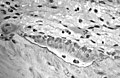 Light micrograph of osteoblasts, several displaying a prominent Golgi apparatus, actively synthesizing osteoid containing two osteocytes.