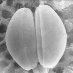 Pennate diatom (bilateral symmetry)