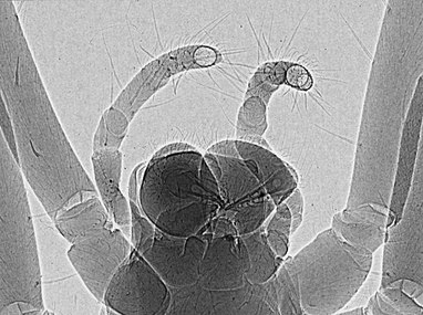 Figure 26. High resolution phase-contrast x-ray image of a spider