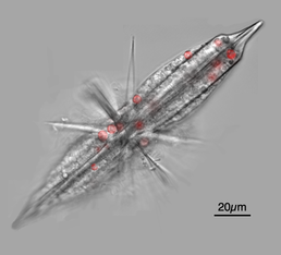 Acantharian radiolarians have celestine crystal shells