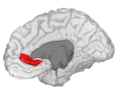 Rostral Anterior Cingulate gyrus
