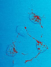 Photomicrograph of mouse neurons showing red stained inclusions identified as scrapies prion protein.