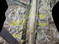 Spinal cord. Spinal membranes and nerve roots. Deep dissection. Posterior view.