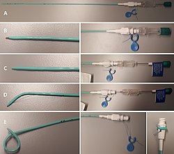 Settings of a pigtail catheter.