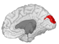 Cuneus, shown in the right cerebral hemisphere.
