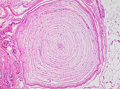 Histology of a Pacinian corpuscle, in a typical expanding circular pattern.
