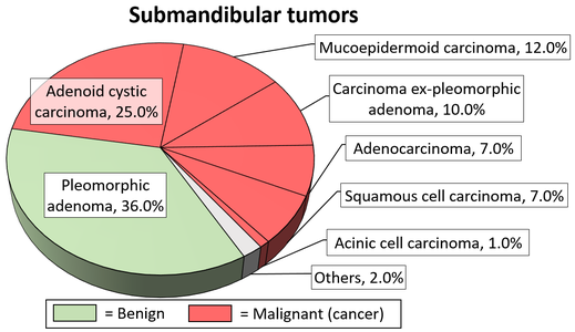 Relative incidence of submandibular tumors, showing carcinoma ex pleomorphic adenoma at top-right.[3]