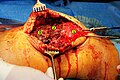 Operative image: 1. Kneecap 2. upper patella pole with drill holes 3. Stump of the quadriceps tendon