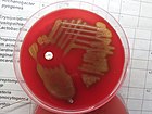 Streptococcus pneumoniae: small colonies with raised edges displaying alpha-hemolysis on blood agar[8]: 223 