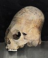 Elongated skull excavated in Samarkand, 600-800 CE