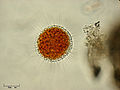 Vampyrella sp. (Cercozoa: Vampyrellidae)