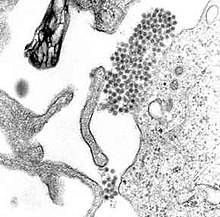 A TEM micrograph showing "Dengue virus" virions (the cluster of dark dots near the center)