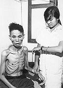 Starved Vietnamese man, 1966