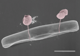 Pennate diatom from an Arctic meltpond, infected with two chytrid-like fungal pathogens. Scale bar = 10 μm.[70]