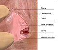 Female urethral opening within vulval vestibule