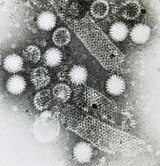 Electron micrograph of EDIM - the rotavirus that infects mice